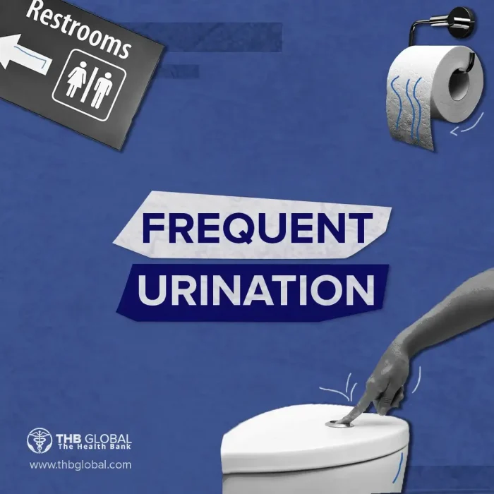 frequent-urination